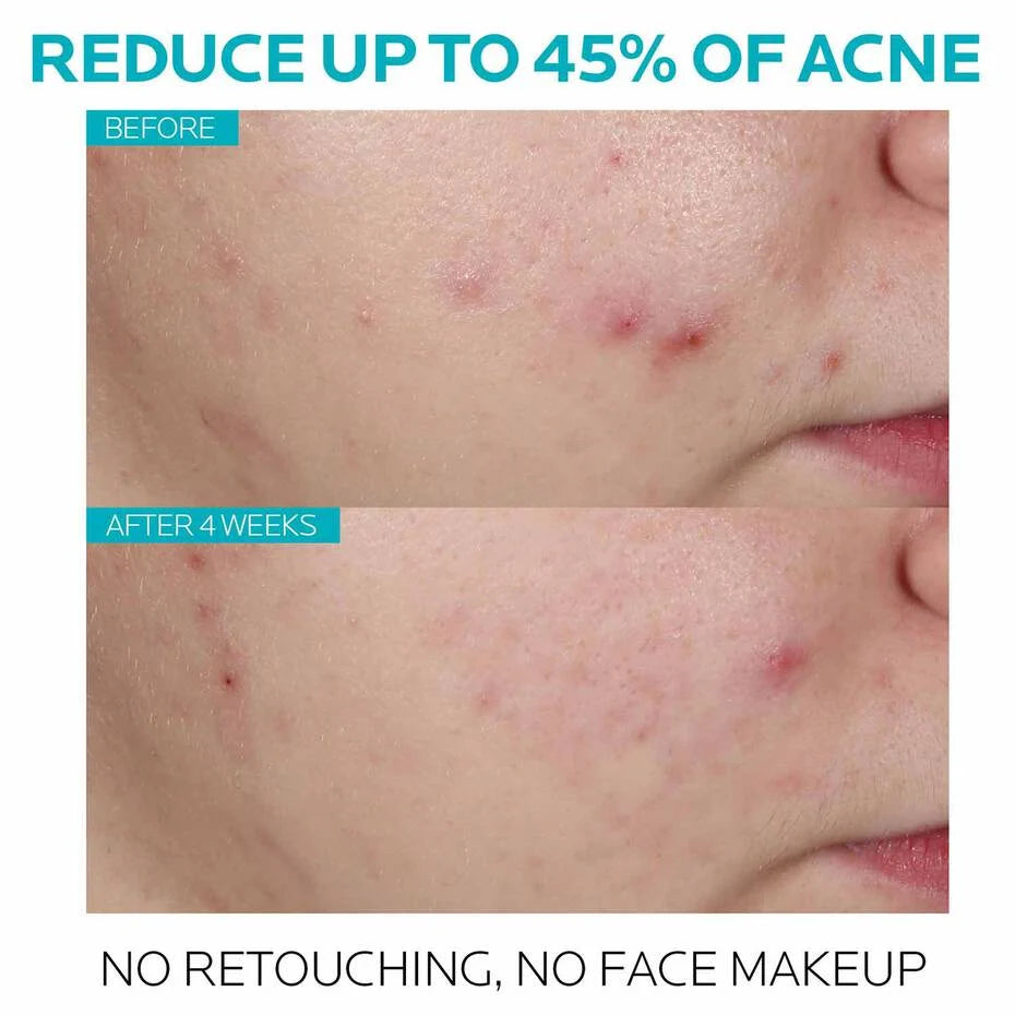 EFFACLAR SALICYLIC ACID ACNE TREATMENT SERUM - LA ROCHE - POSAY.