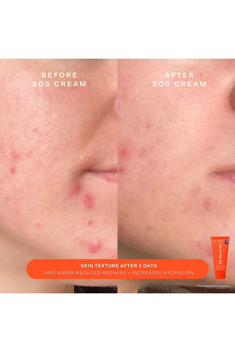 SOS Rescue Bestsellers Kit - Tower 28