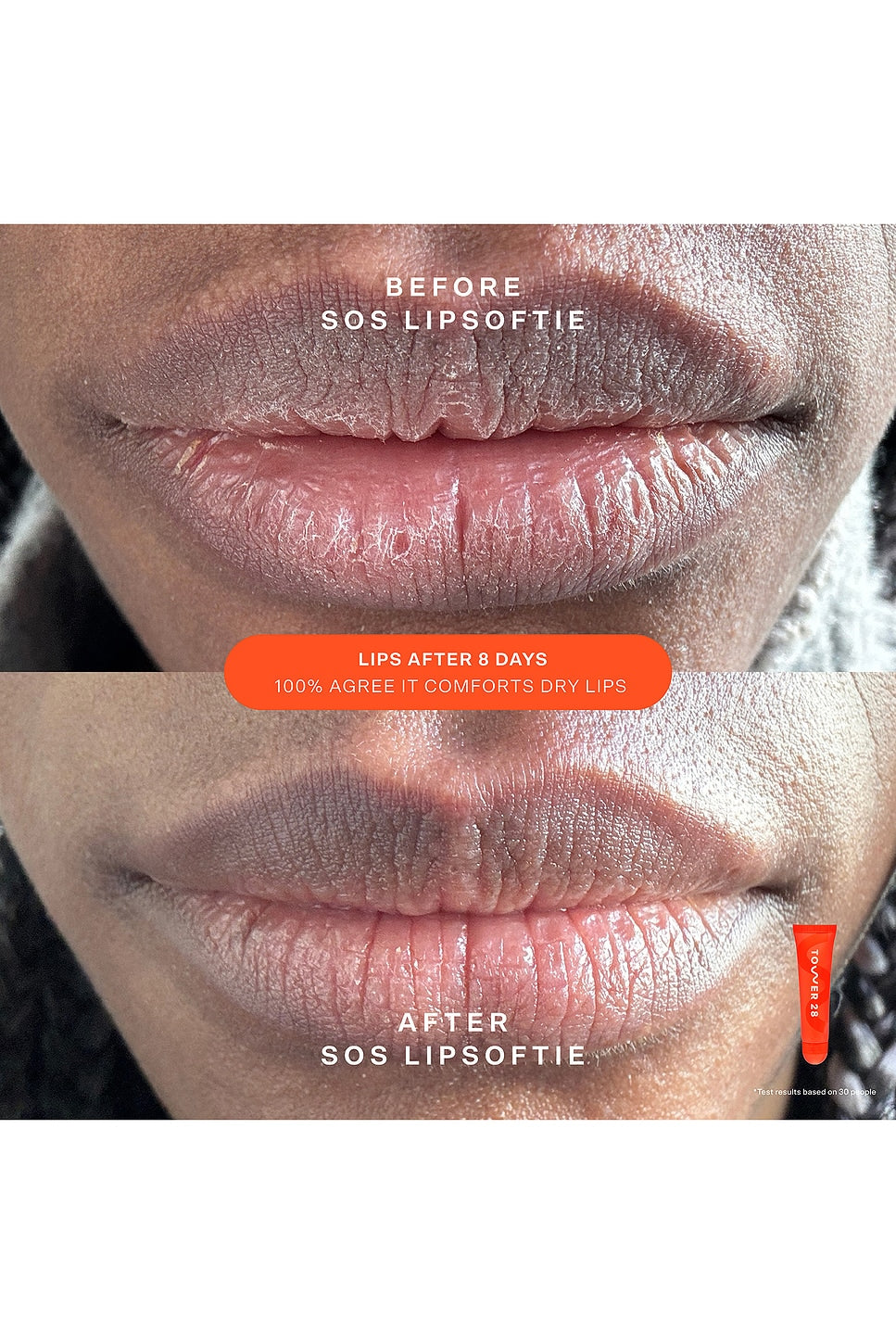 SOS Rescue Bestsellers Kit - Tower 28