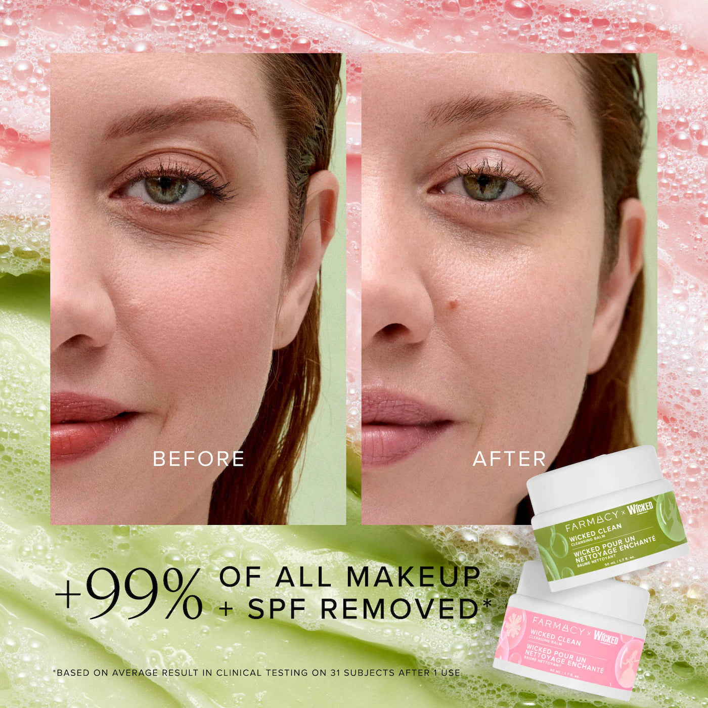 Wicked Clean Kit Limited-Edition - Farmacy PREVENTA