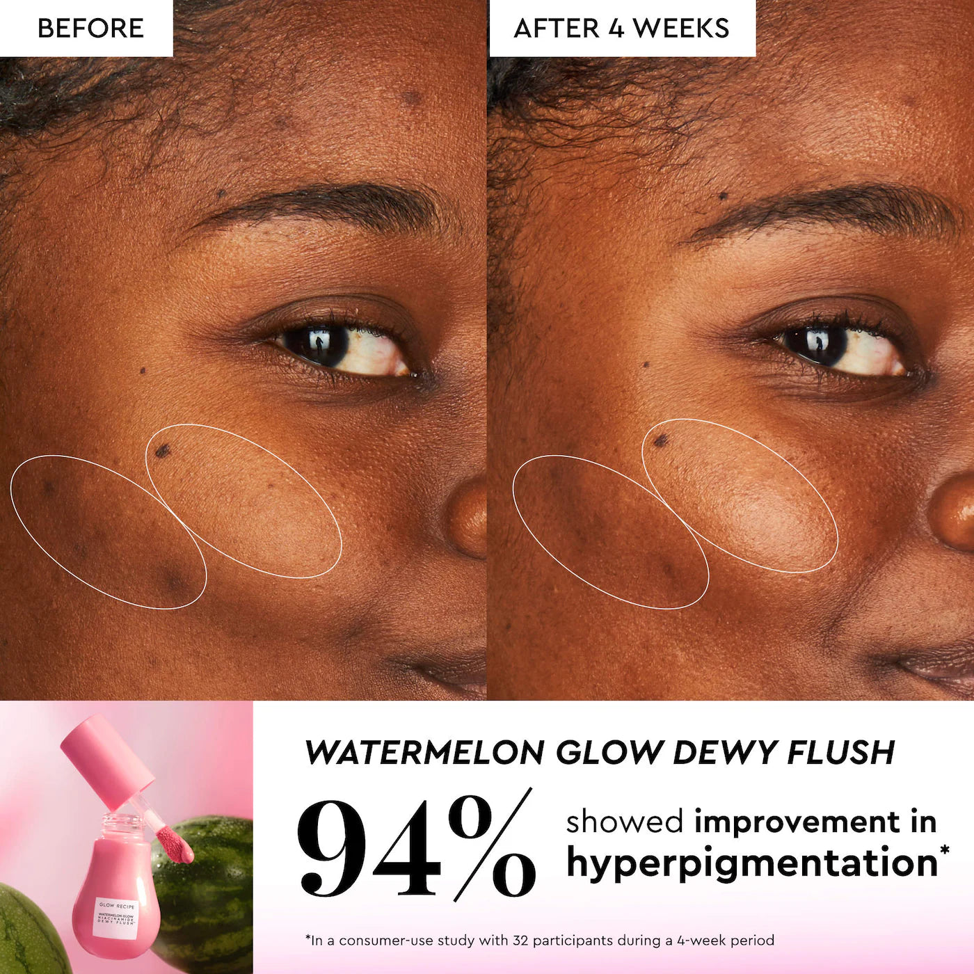 Glow Recipe X Beautyblender Watermelon Glow Bestsellers - Glow Recipe PREVENTA.